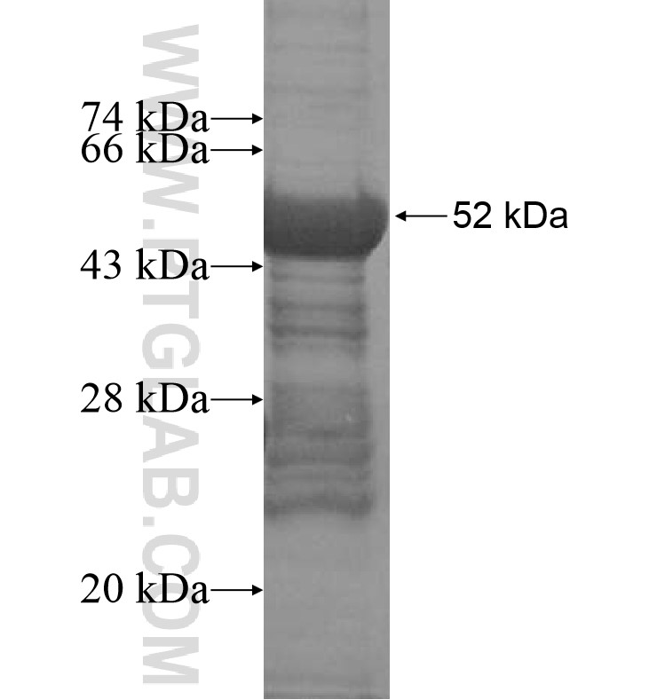 MAGEB10 fusion protein Ag16163 SDS-PAGE MAGEB10 fusion protein Ag16163 SDS-PAGE