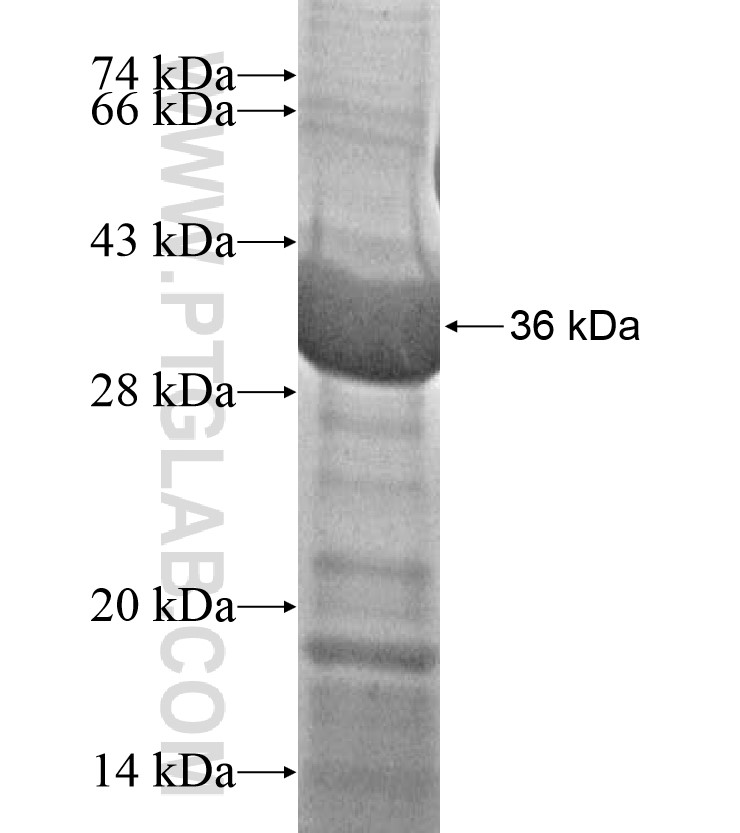 MAGEB10 fusion protein Ag17032 SDS-PAGE MAGEB10 fusion protein Ag17032 SDS-PAGE