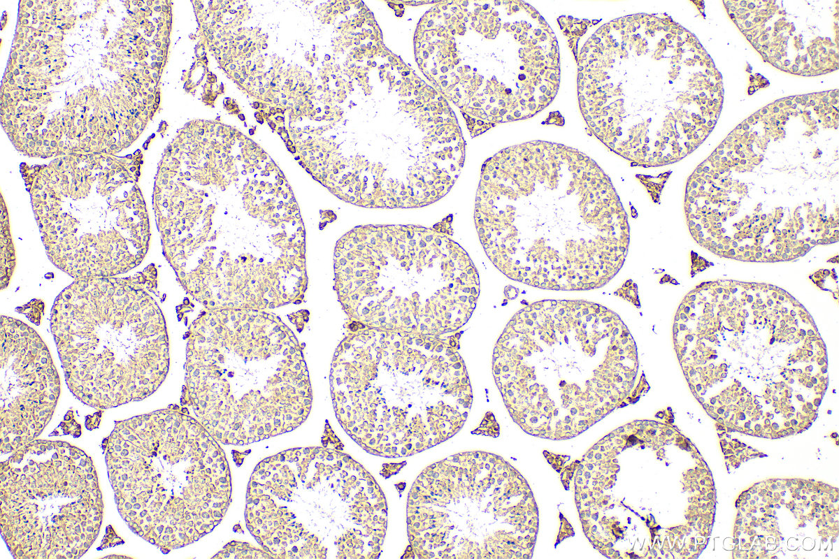 IHC staining of mouse testis using 18000-1-AP