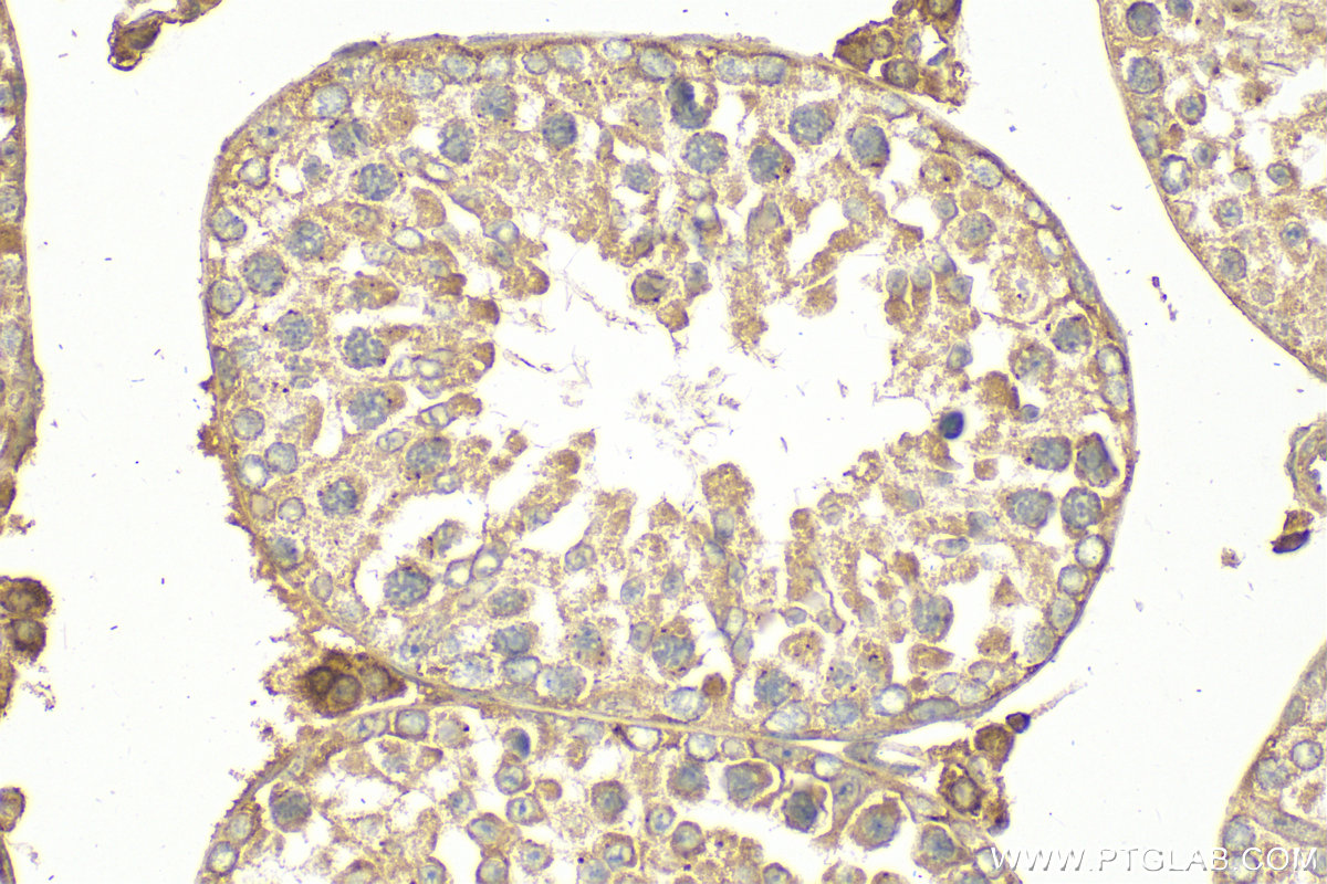 IHC staining of mouse testis using 18000-1-AP (same clone as 18000-1-PBS)