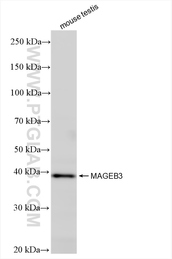 WB analysis using 85191-1-RR