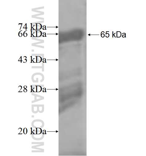 MAGEB4 fusion protein Ag3502 SDS-PAGE