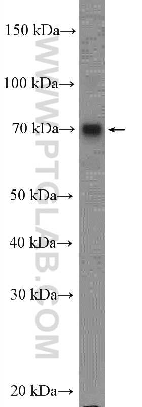 WB analysis of A375 using 21491-1-AP