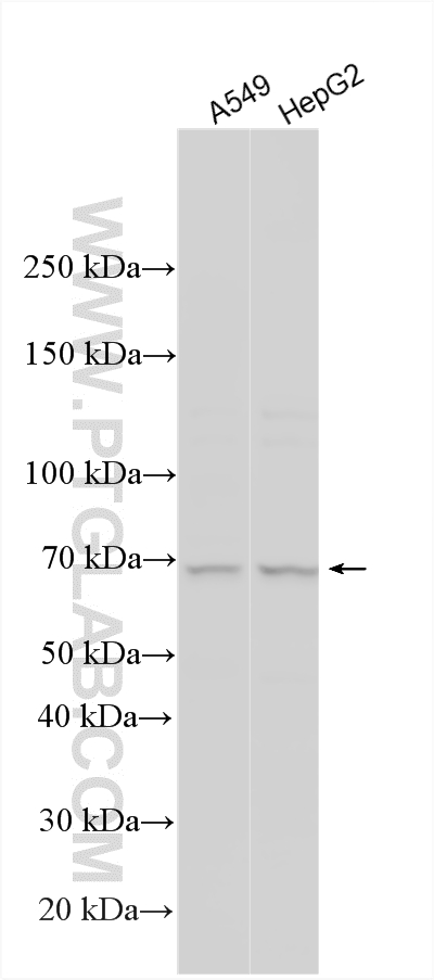 WB analysis using 21491-1-AP WB analysis using 21491-1-AP