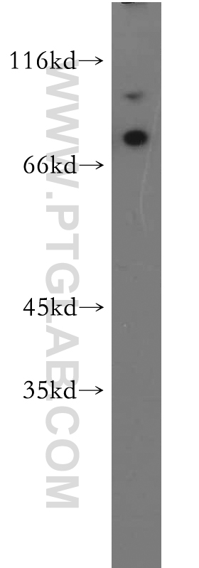 WB analysis of HEK-293 using 11539-1-AP