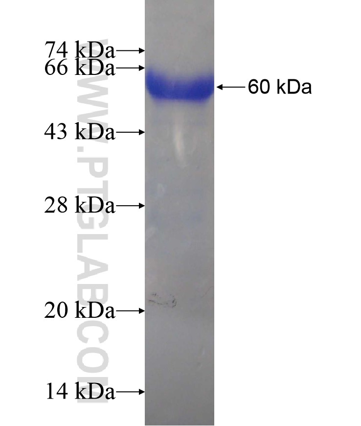 MAGED1 fusion protein Ag17465 SDS-PAGE MAGED1 fusion protein Ag17465 SDS-PAGE