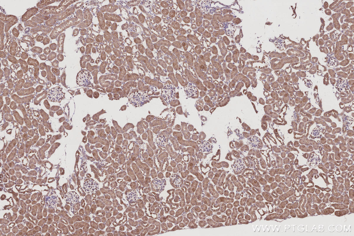 IHC staining of mouse kidney using 15252-1-AP