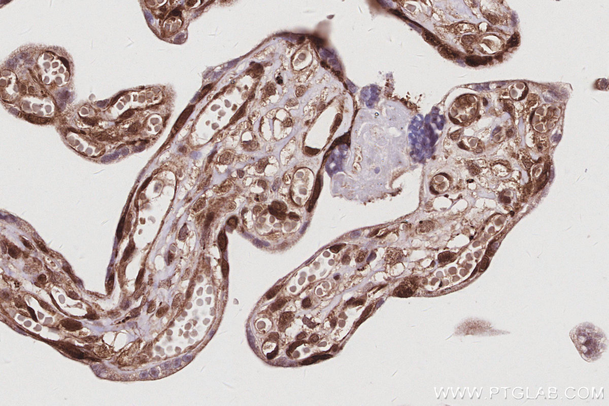 IHC staining of human placenta using 15252-1-AP