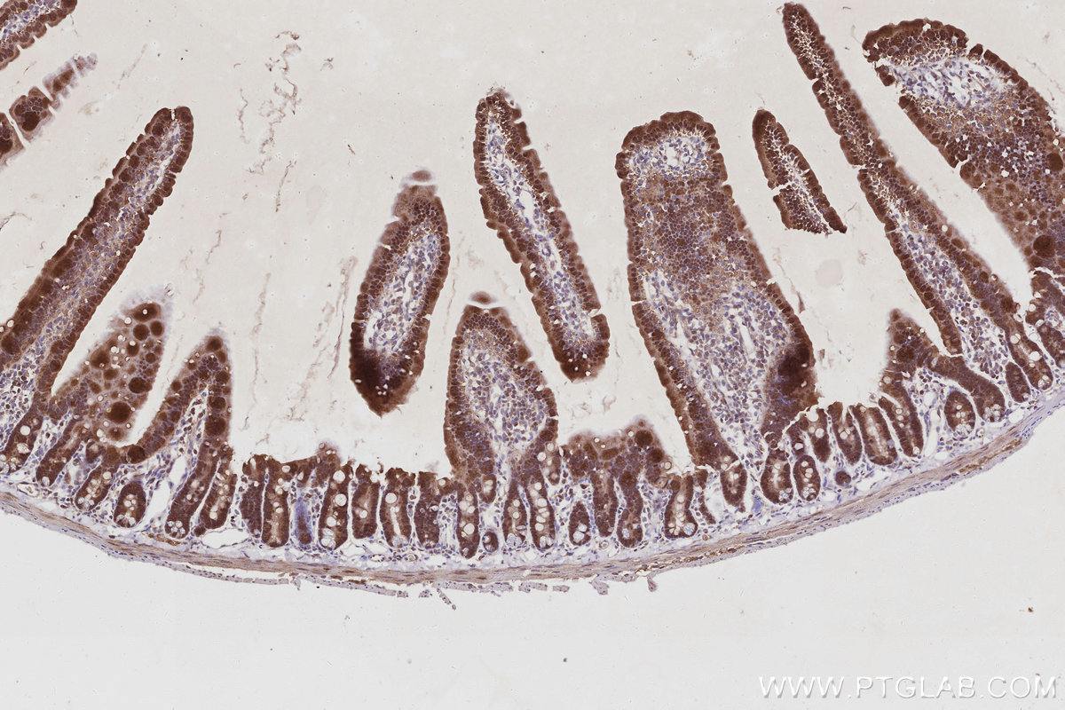 IHC staining of mouse small intestine using 15252-1-AP