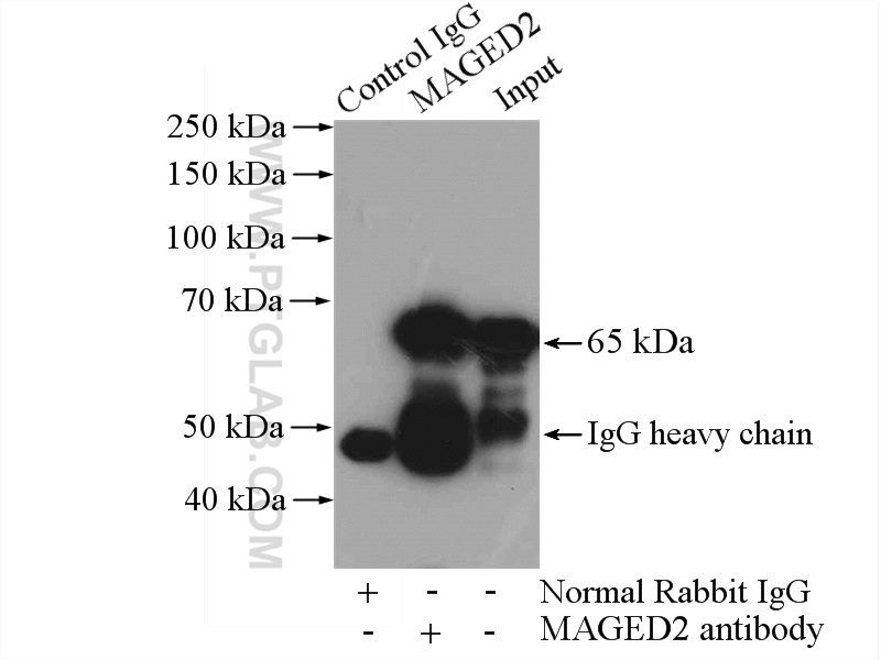 IP experiment of HepG2 using 15252-1-AP