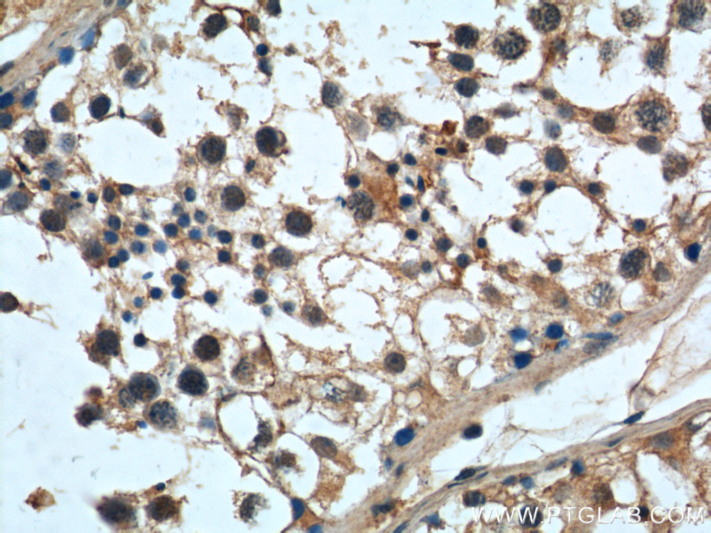 IHC staining of human testis using 24105-1-AP