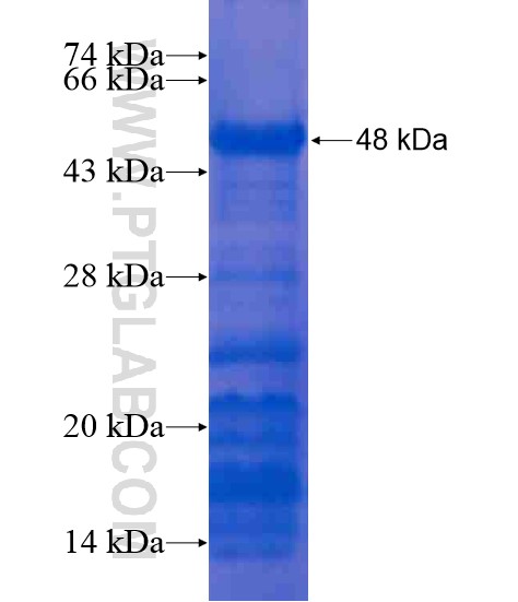 MAGEF1 fusion protein Ag21147 SDS-PAGE