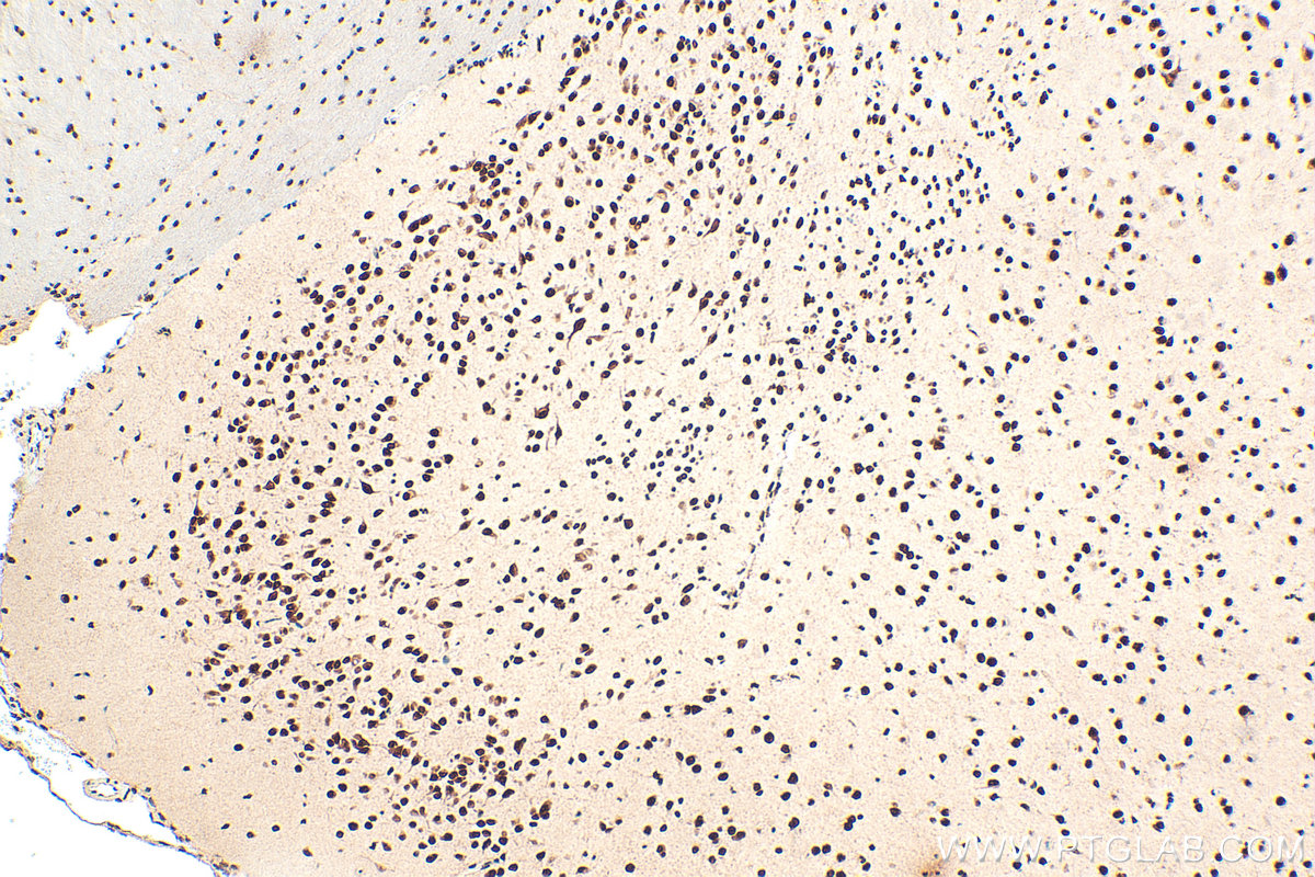 IHC staining of mouse brain using 33836-1-AP