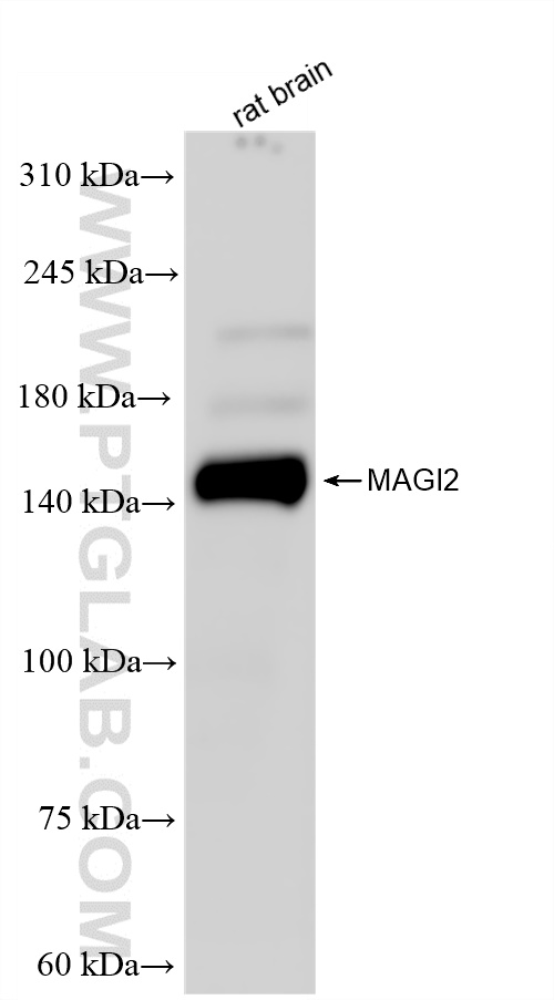 WB analysis of rat brain using 83561-6-RR (same clone as 83561-6-PBS)