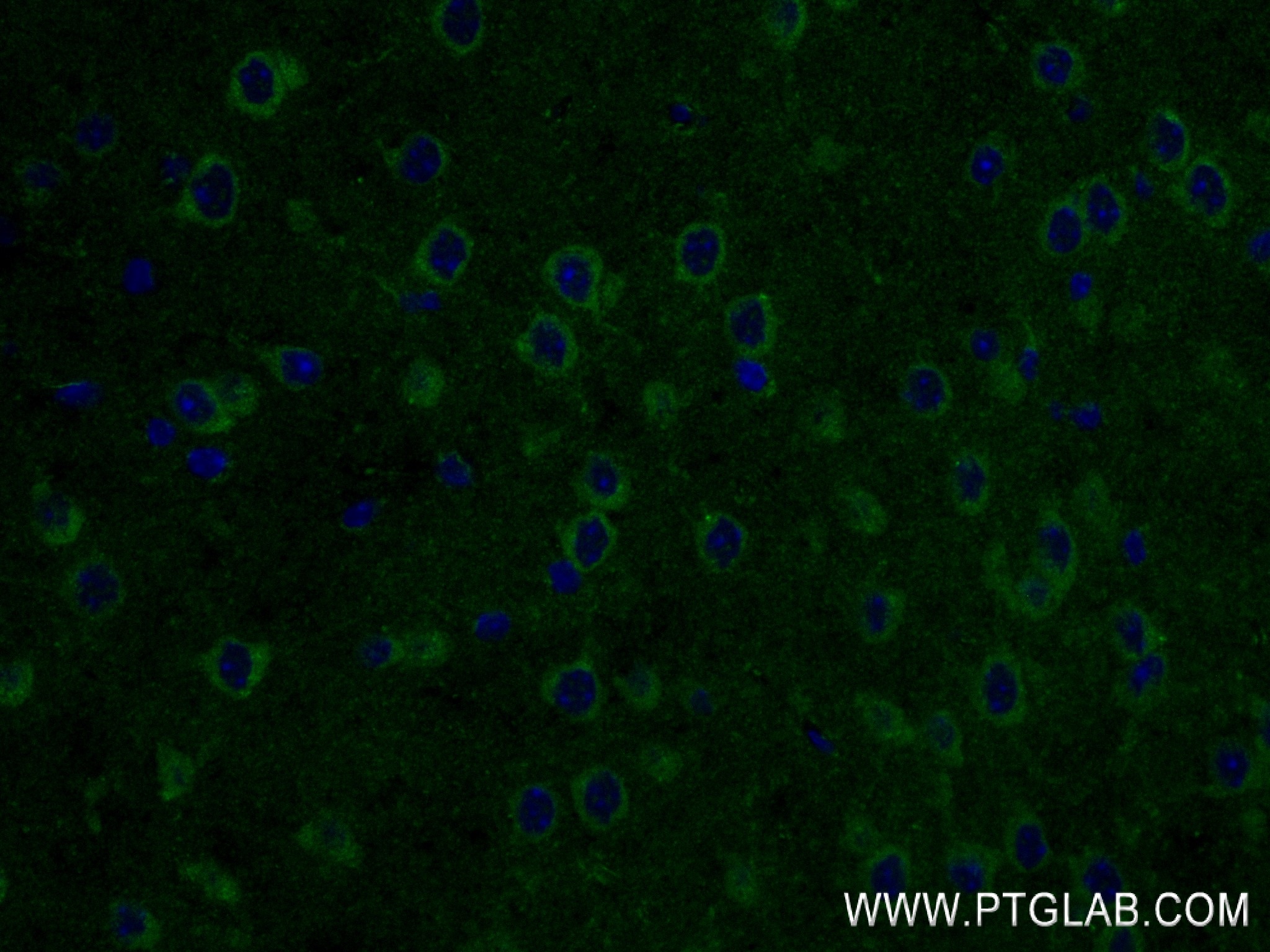 IF Staining of mouse brain using 84771-4-RR
