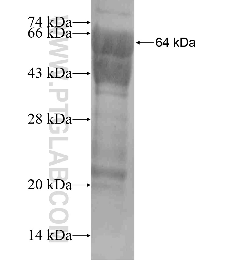 MAGI3 fusion protein Ag18394 SDS-PAGE