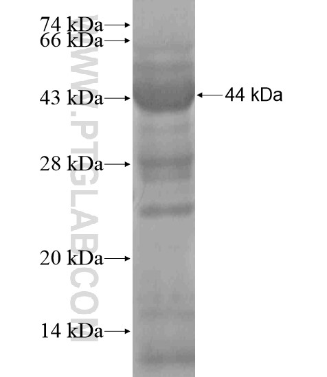 MAGI3 fusion protein Ag18593 SDS-PAGE MAGI3 fusion protein Ag18593 SDS-PAGE