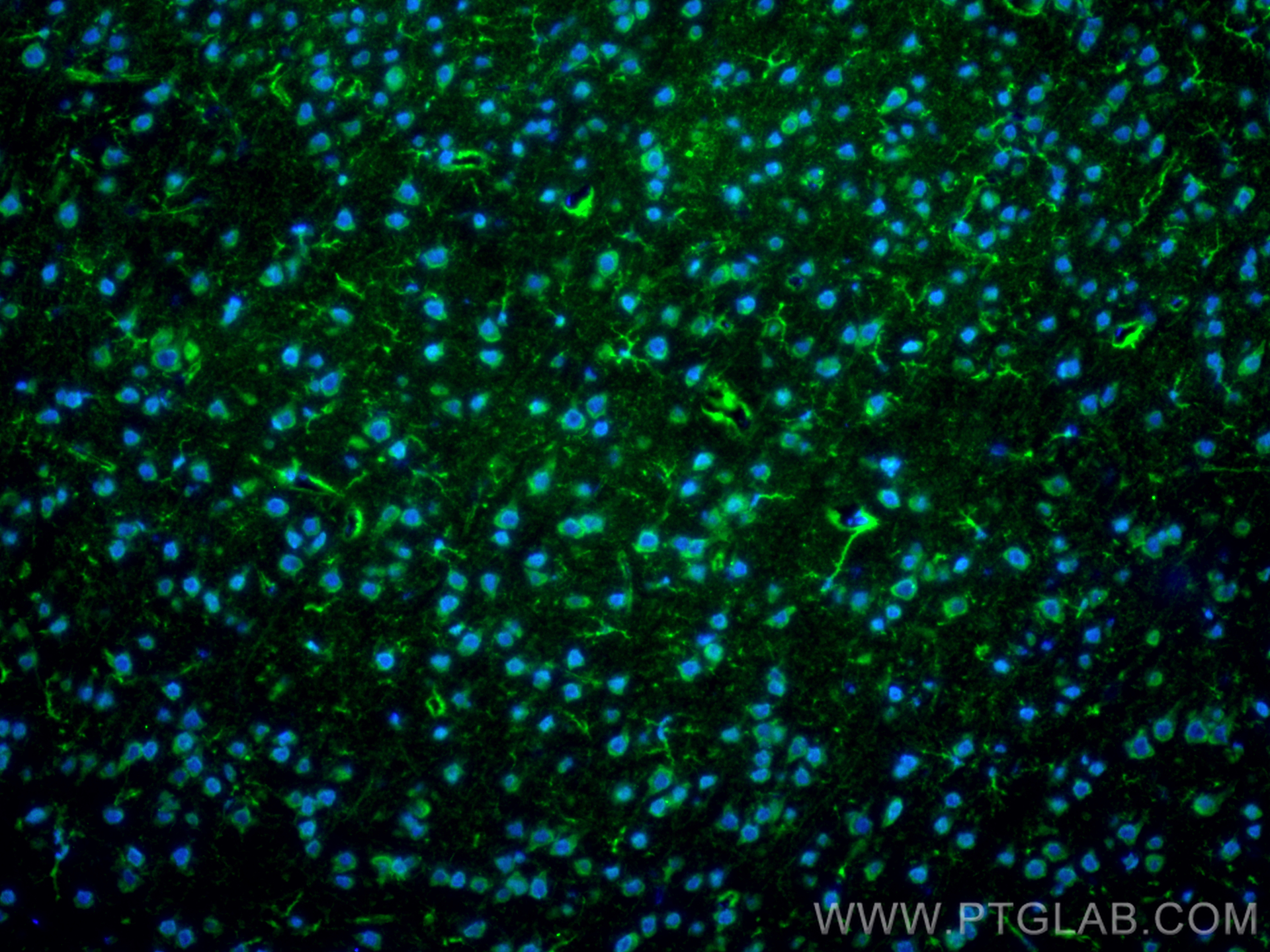 IF Staining of mouse brain using 17430-1-AP
