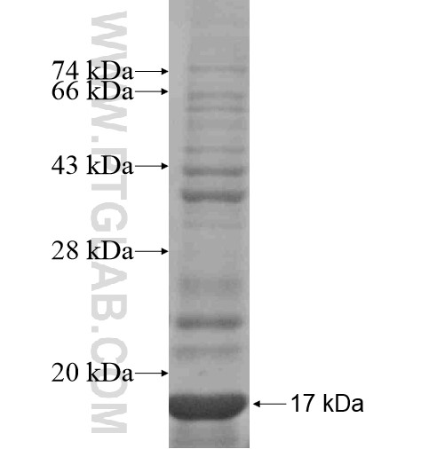 MAGT1 fusion protein Ag11477 SDS-PAGE MAGT1 fusion protein Ag11477 SDS-PAGE