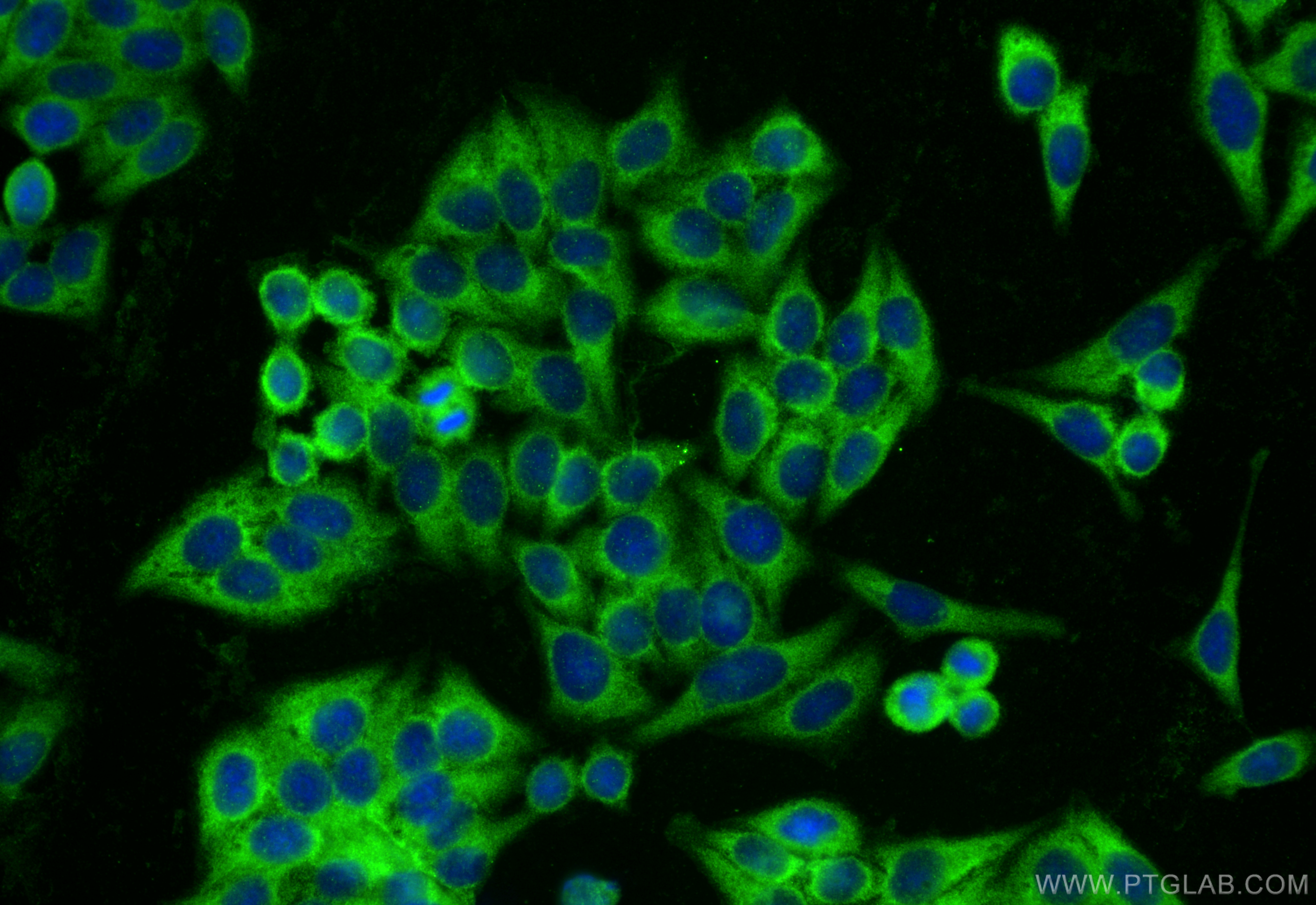 IF Staining of HepG2 using 11660-1-AP