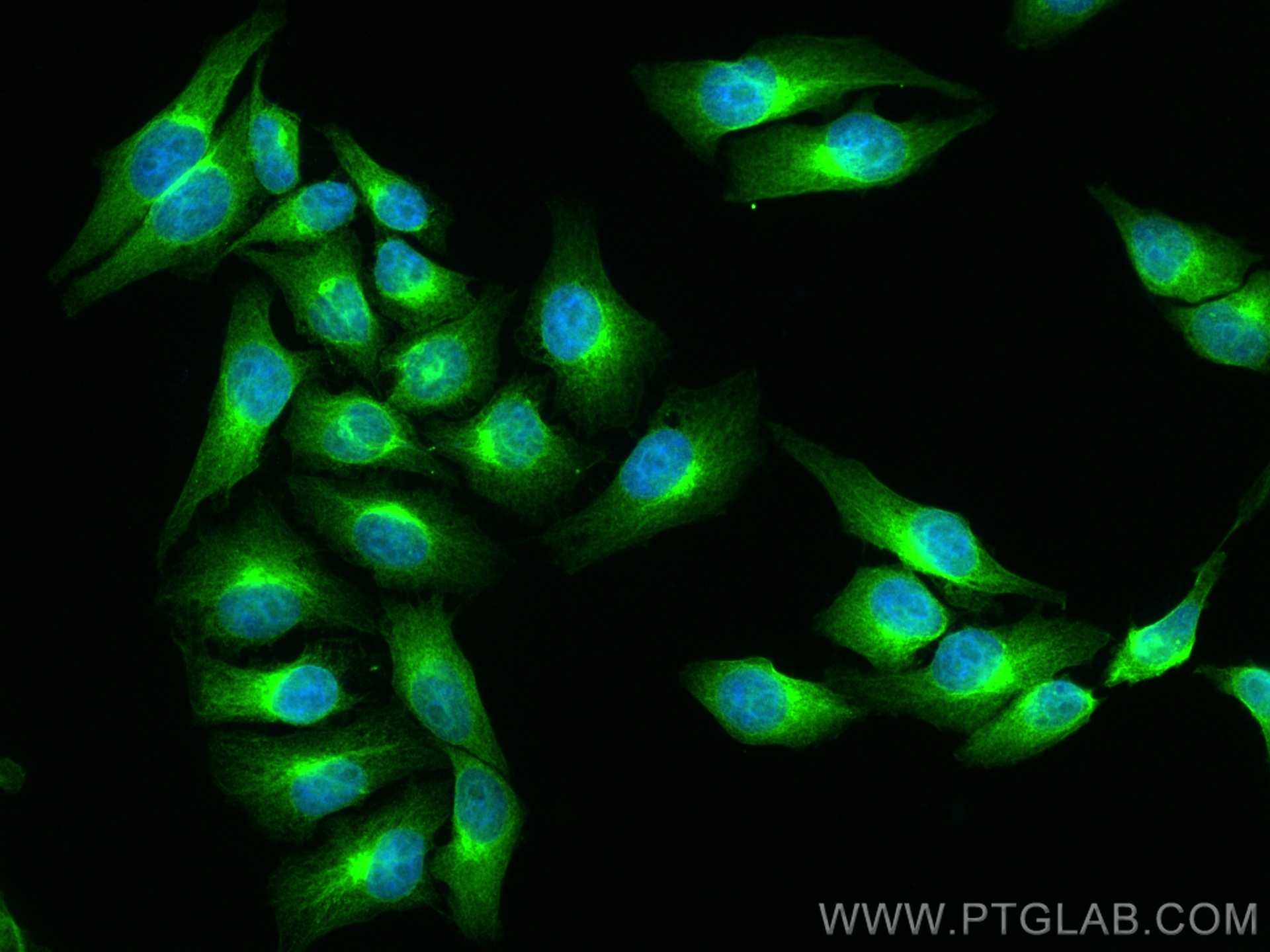 IF Staining of HepG2 using 23382-1-AP