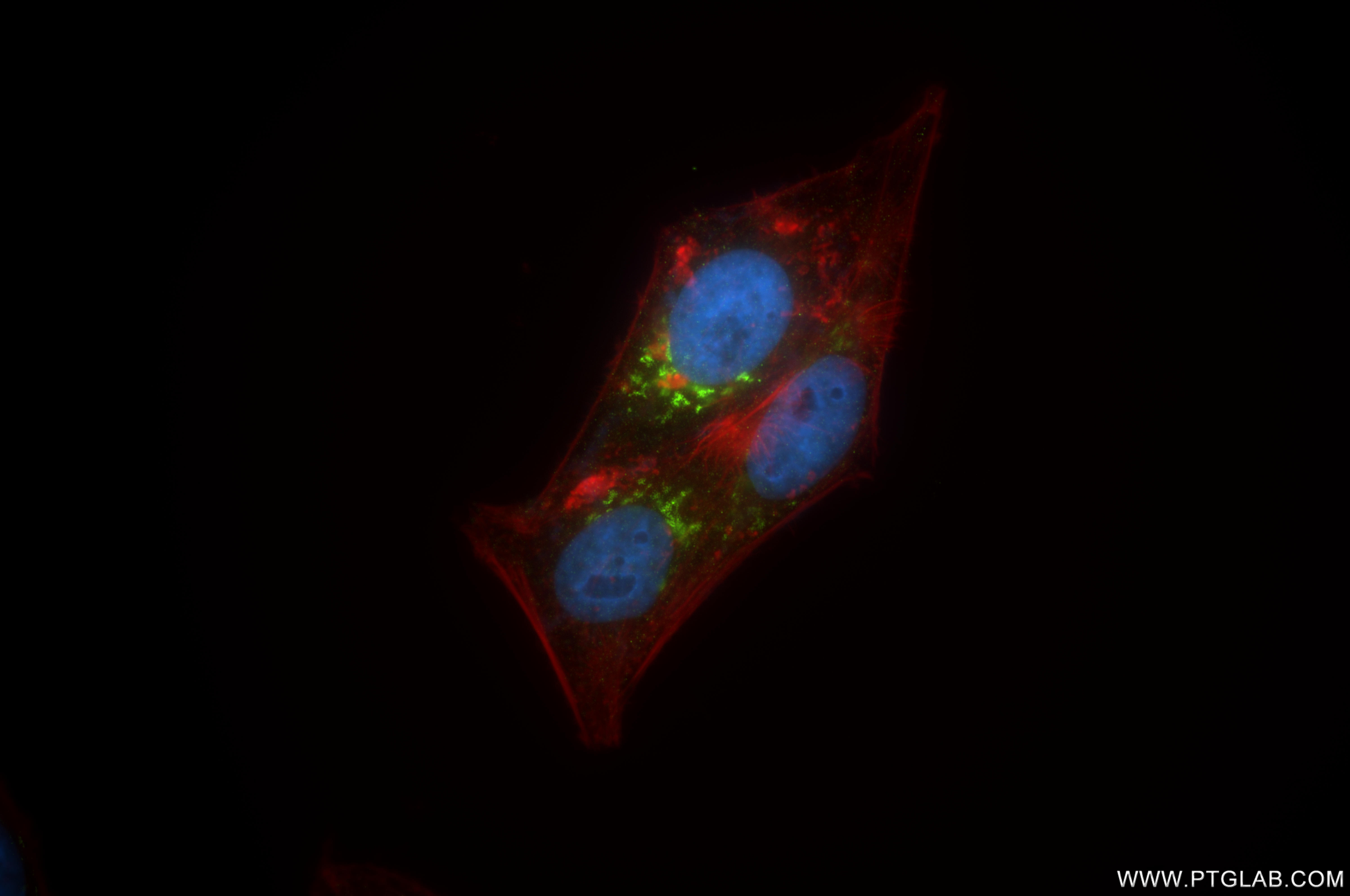 IF Staining of HepG2 using 86094-1-RR