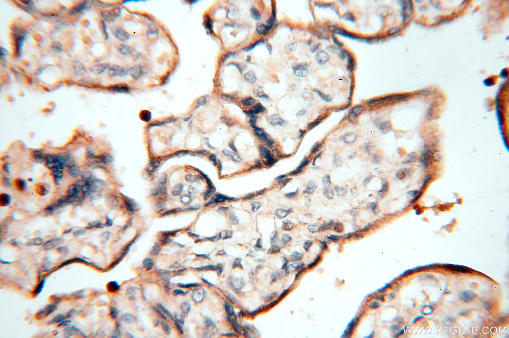 IHC staining of human placenta using 14049-1-AP