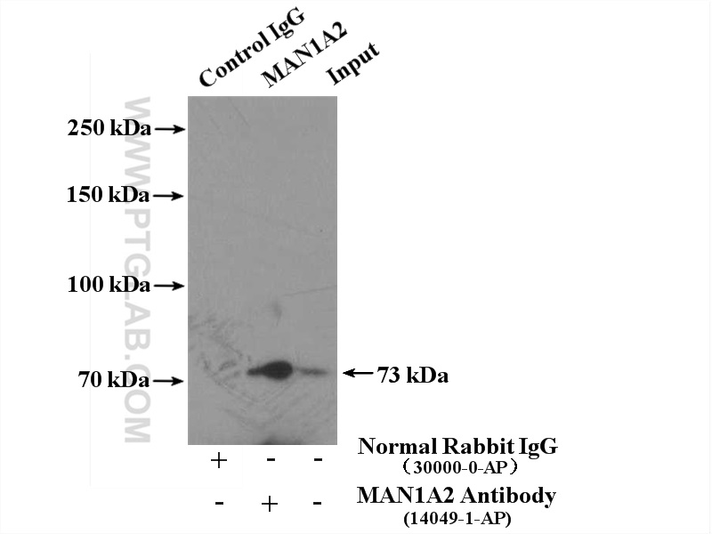 IP experiment of human placenta using 14049-1-AP