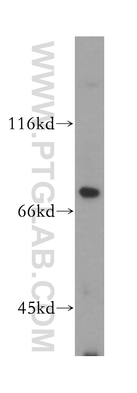 WB analysis of human placenta using 14049-1-AP