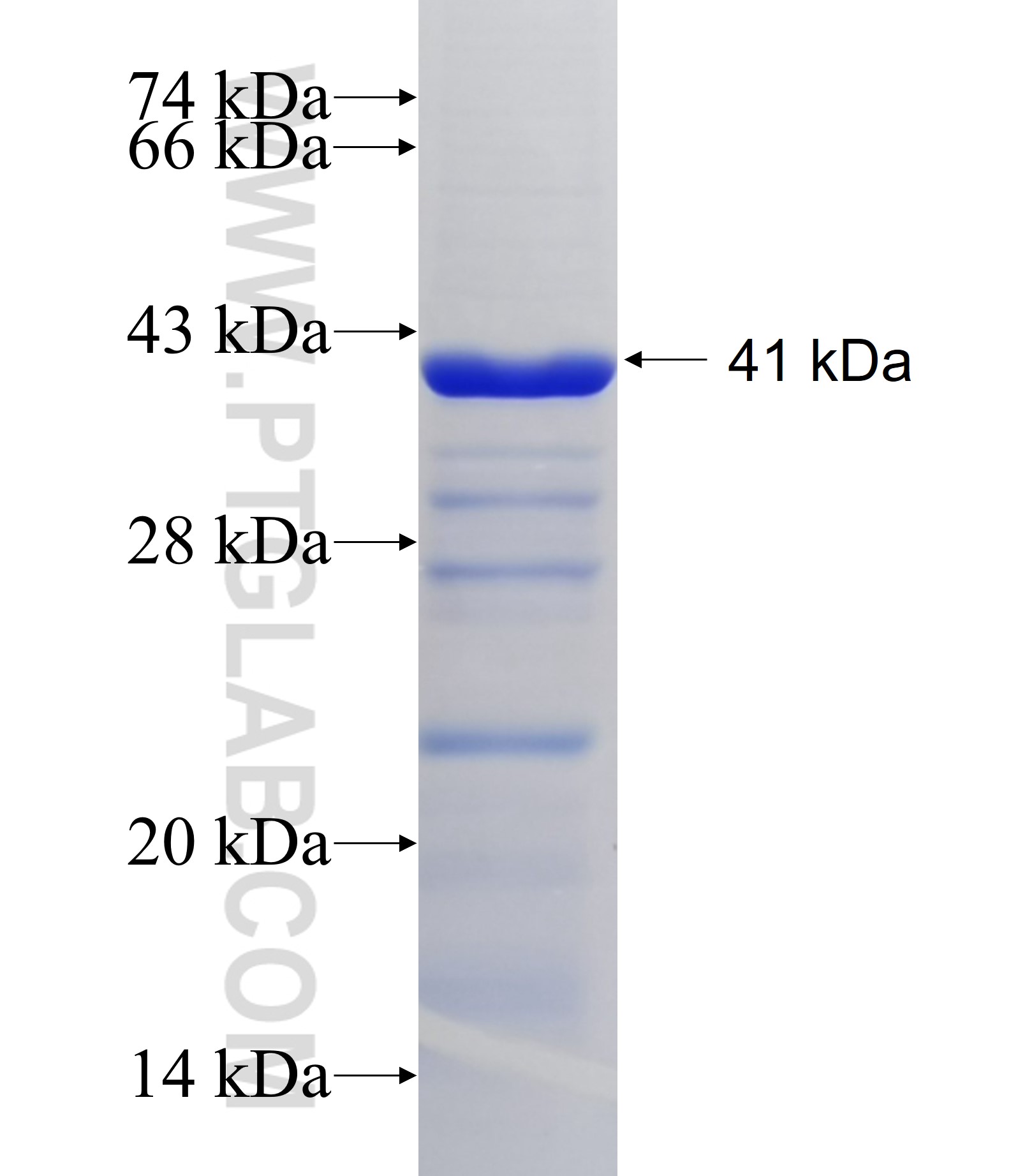 MAN1A2 fusion protein Ag5488 SDS-PAGE