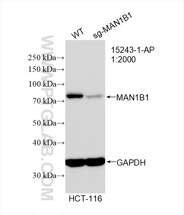 WB analysis of HCT 116 using 15243-1-AP
