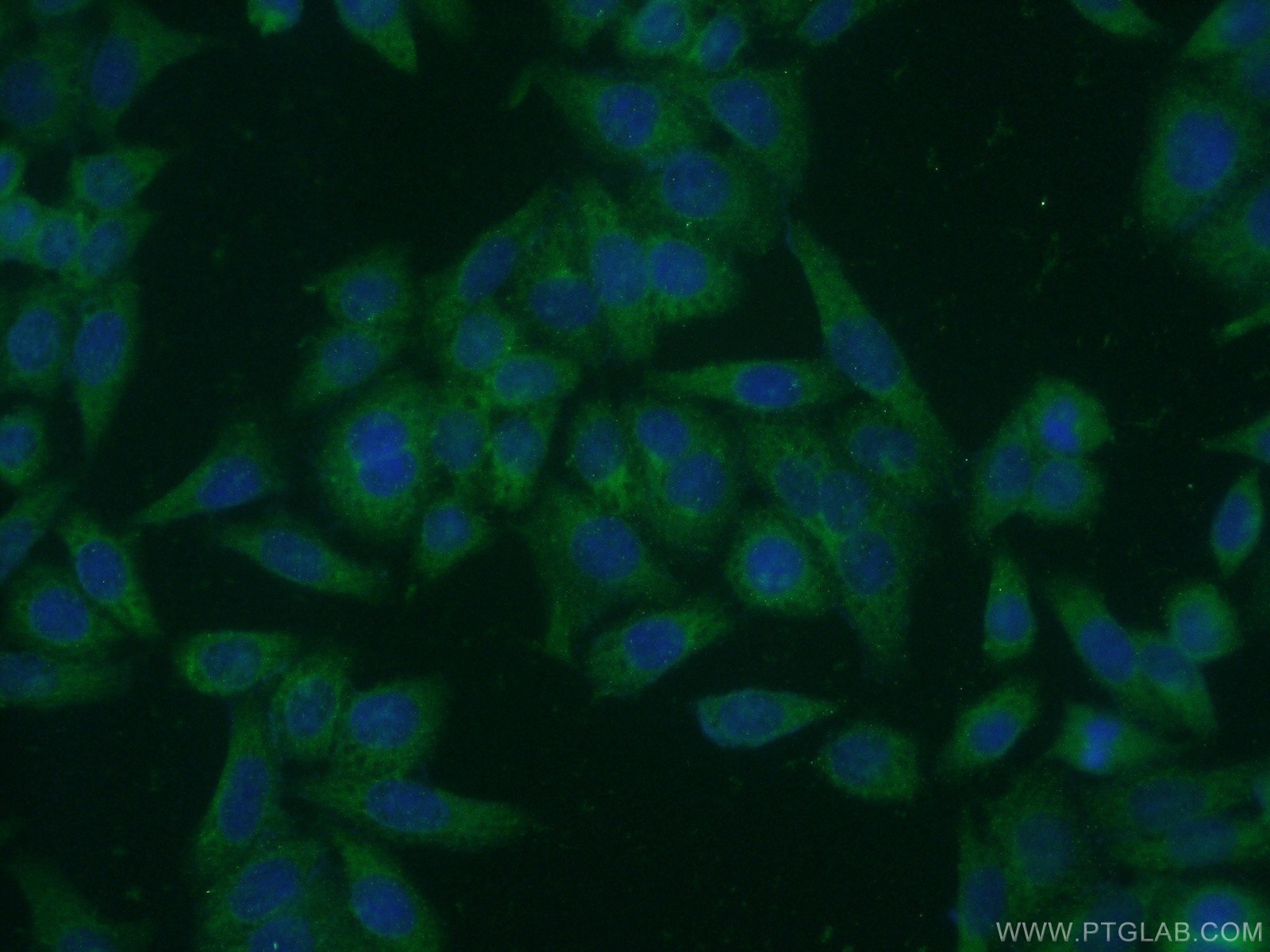 IF Staining of HeLa using 21132-1-AP