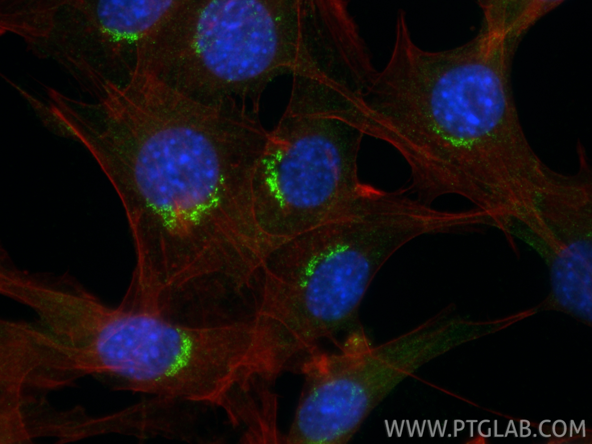 Immunofluorescent analysis of (4% PFA) fixed NIH/3T3 cells using MAN2A1 antibody (21132-1-AP) at dilution of 1:200 and CoraLite®488-Conjugated Goat Anti-Rabbit IgG(H+L) (<a class='green' href='/productredirect?CatalogNo=SA00013-2' target='_blank'>SA00013-2</a>), CL594-phalloidin (red). IF Staining of NIH/3T3 using 21132-1-AP