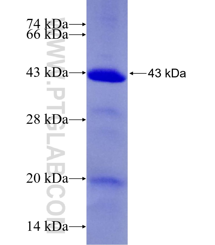 MAN2B2 fusion protein Ag29258 SDS-PAGE