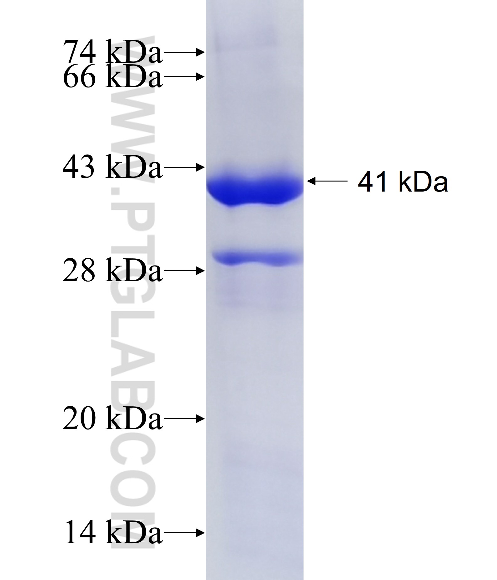 MANBA fusion protein Ag9421 SDS-PAGE