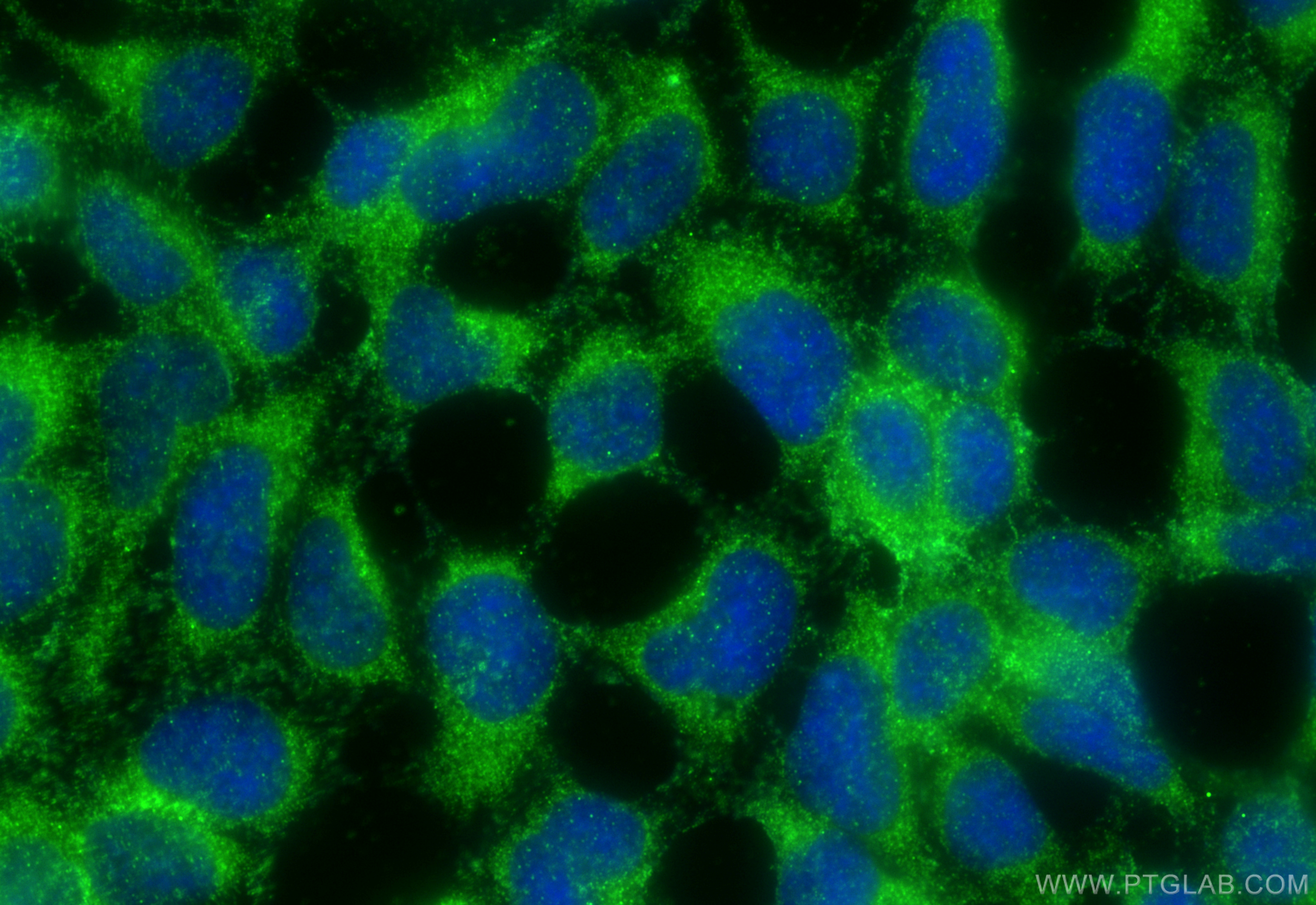 IF Staining of HEK-293 using 21296-1-AP