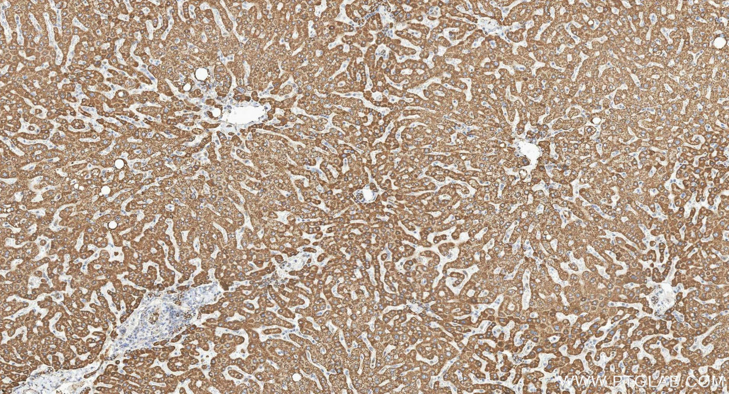 IHC staining of human liver using 12602-1-AP IHC staining of human liver using 12602-1-AP