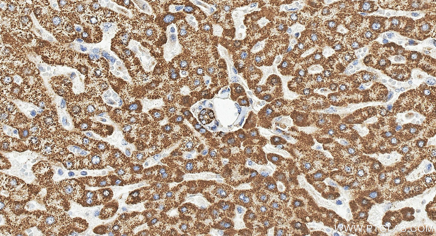 IHC staining of human liver using 12602-1-AP IHC staining of human liver using 12602-1-AP