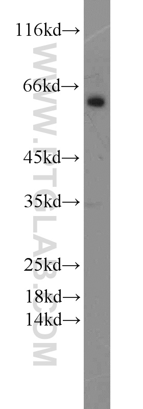 WB analysis of mouse liver using 55263-1-AP