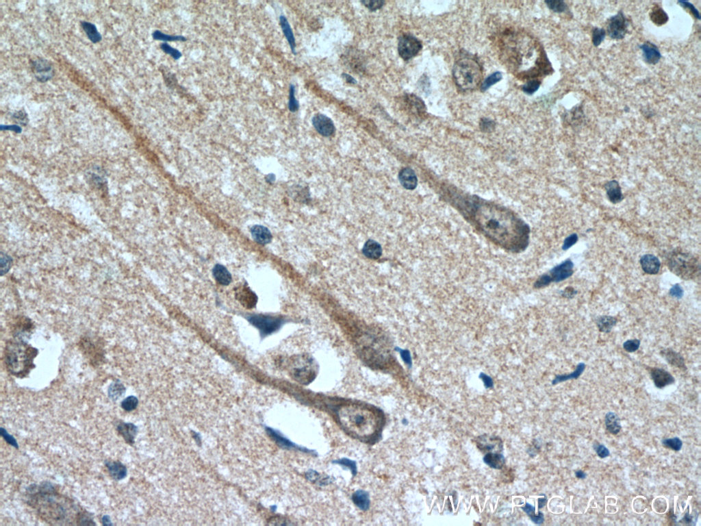 IHC staining of human brain using 66107-1-Ig