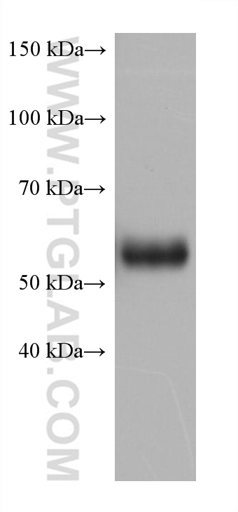 WB analysis of fetal human brain using 66107-1-Ig