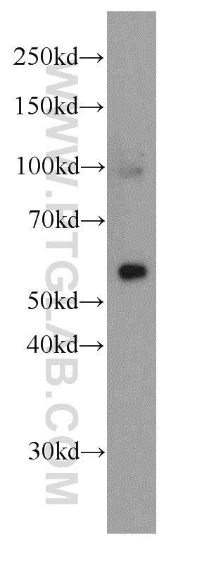 WB analysis of human brain using 66107-1-Ig