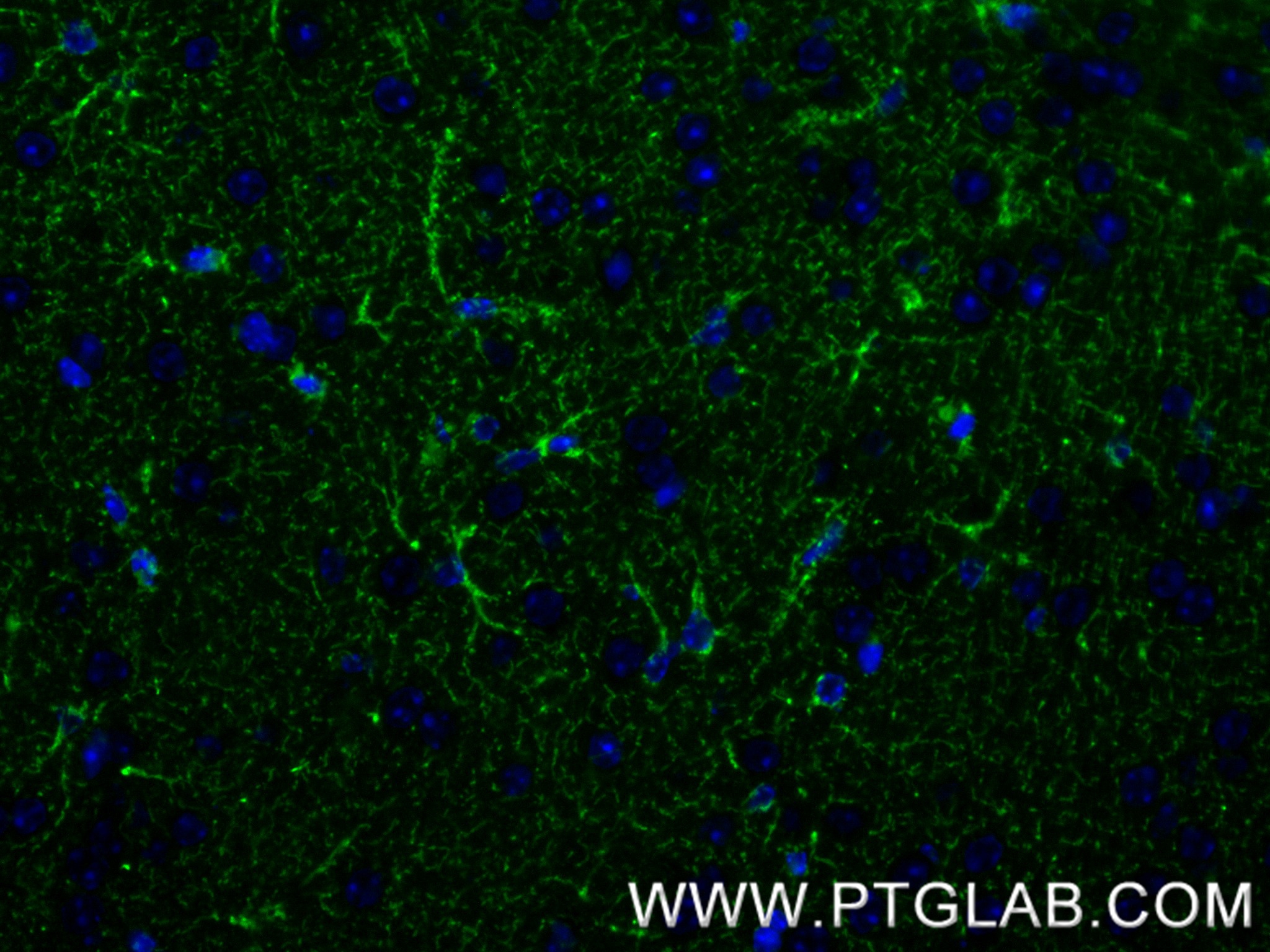IF Staining of mouse brain using 86695-1-RR (same clone as 86695-1-PBS) IF Staining of mouse brain using 86695-1-RR (same clone as 86695-1-PBS)