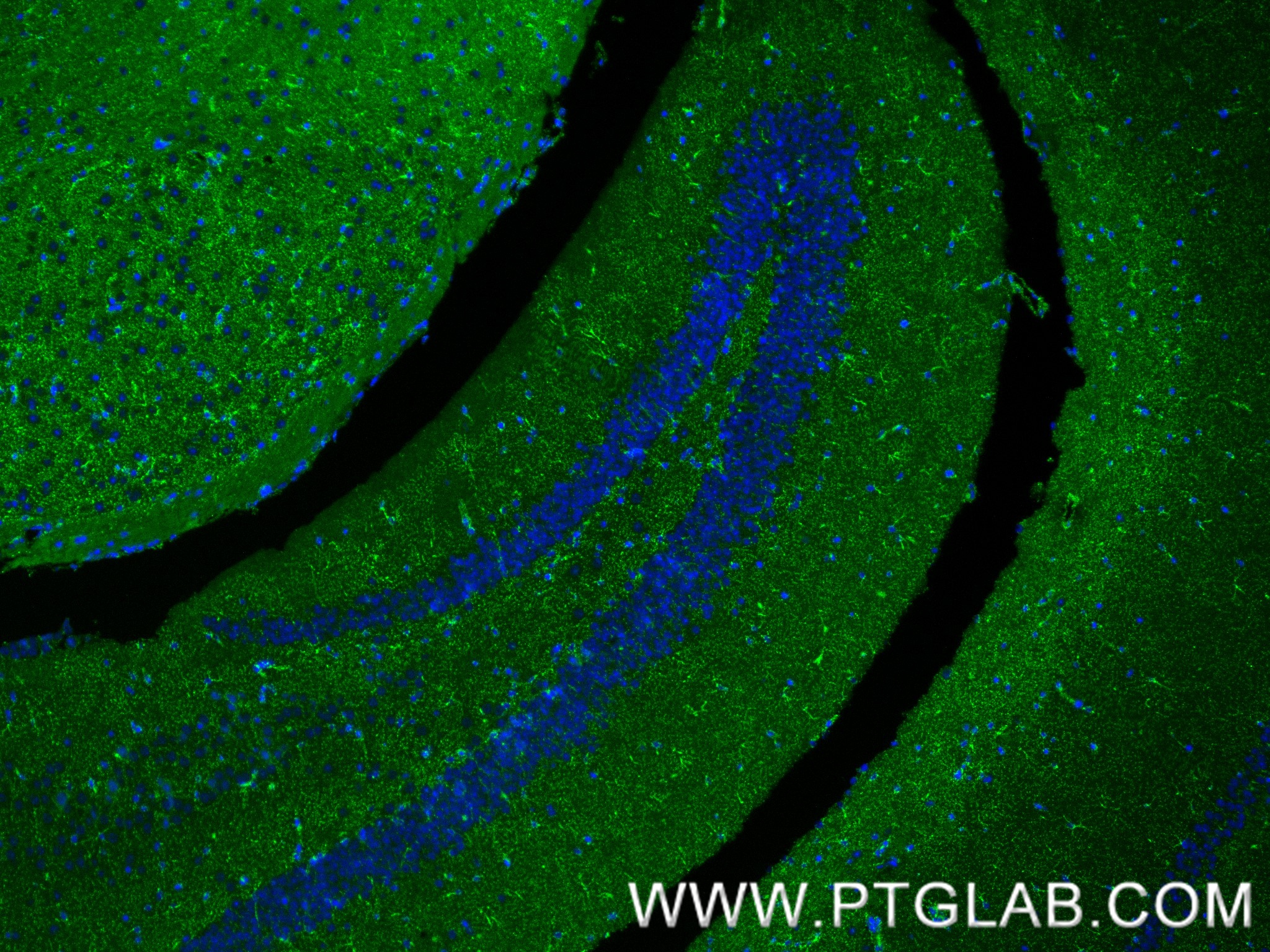 IF Staining of mouse brain using 86695-1-RR (same clone as 86695-1-PBS) IF Staining of mouse brain using 86695-1-RR (same clone as 86695-1-PBS)