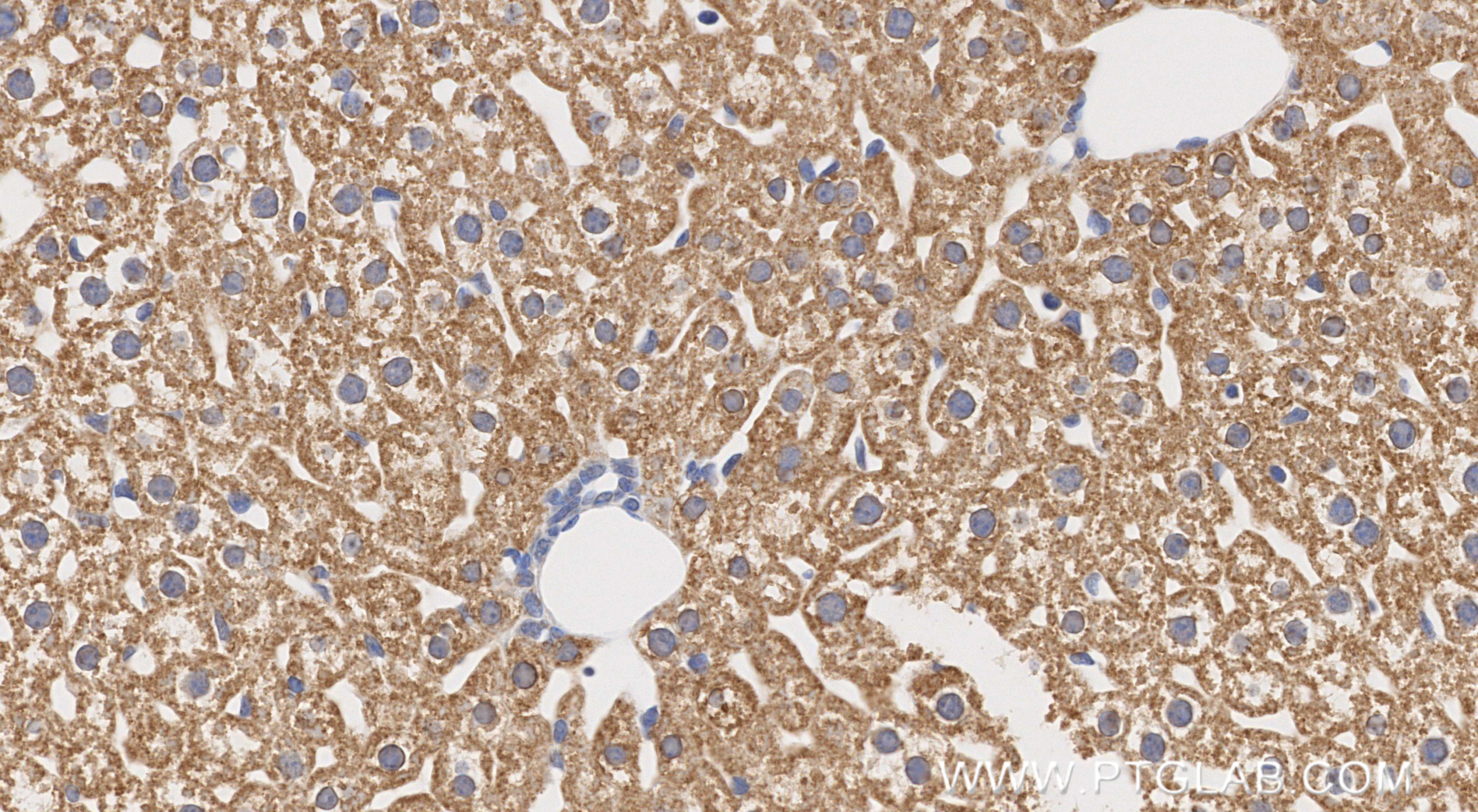 Immunohistochemical analysis of paraffin-embedded mouse liver tissue slide using 86695-1-RR (MAOB antibody) at dilution of 1:1000 (under 40x lens). Heat mediated antigen retrieval with Tris-EDTA buffer (pH 9.0). IHC staining of mouse liver using 86695-1-RR