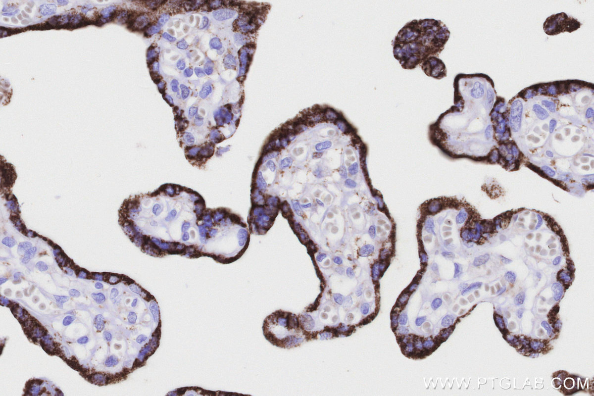 IHC staining of human placenta using 86695-1-RR (same clone as 86695-1-PBS) IHC staining of human placenta using 86695-1-RR (same clone as 86695-1-PBS)