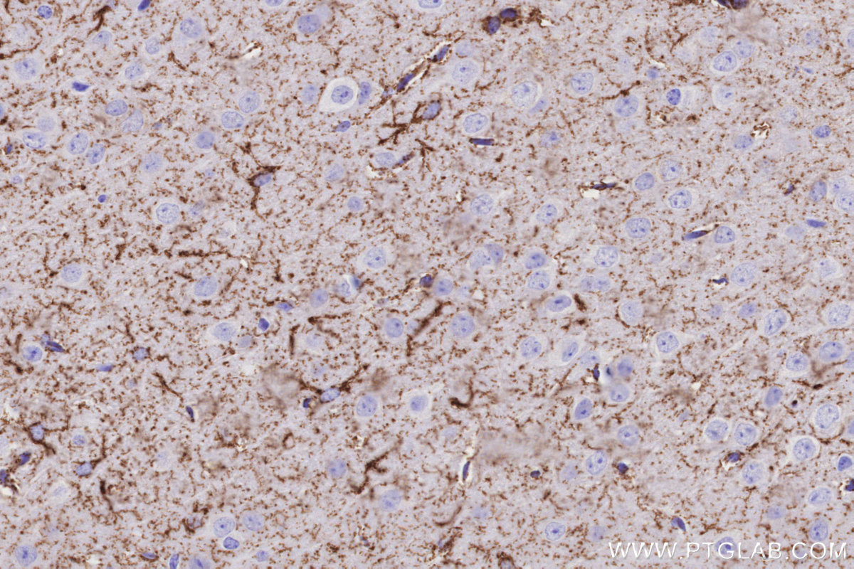 IHC staining of mouse brain using 86695-1-RR (same clone as 86695-1-PBS) IHC staining of mouse brain using 86695-1-RR (same clone as 86695-1-PBS)
