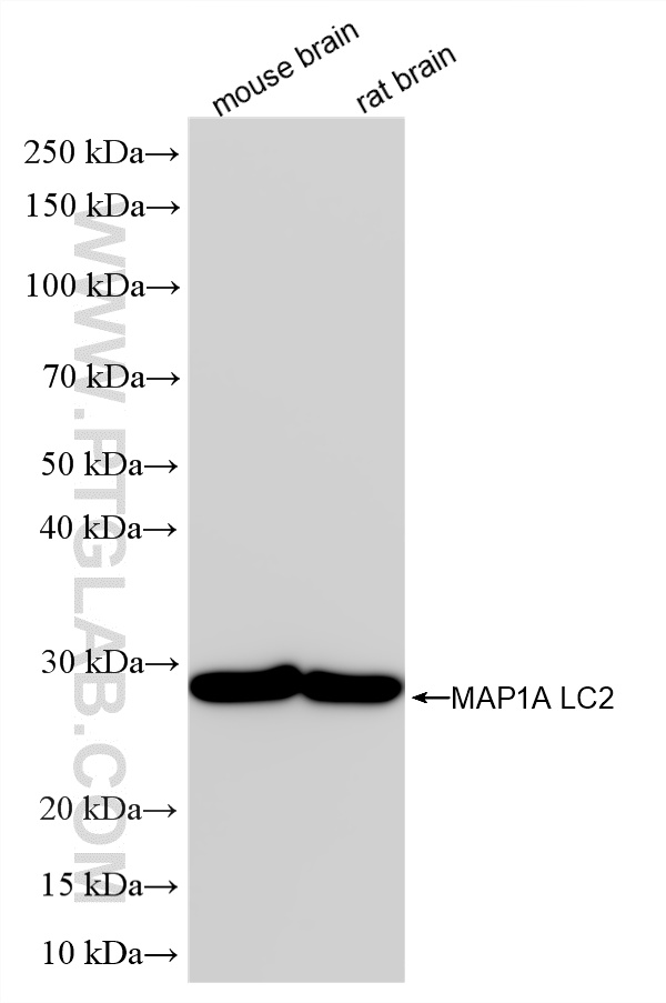 WB analysis using 87623-1-RR (same clone as 87623-1-PBS) WB analysis using 87623-1-RR (same clone as 87623-1-PBS)