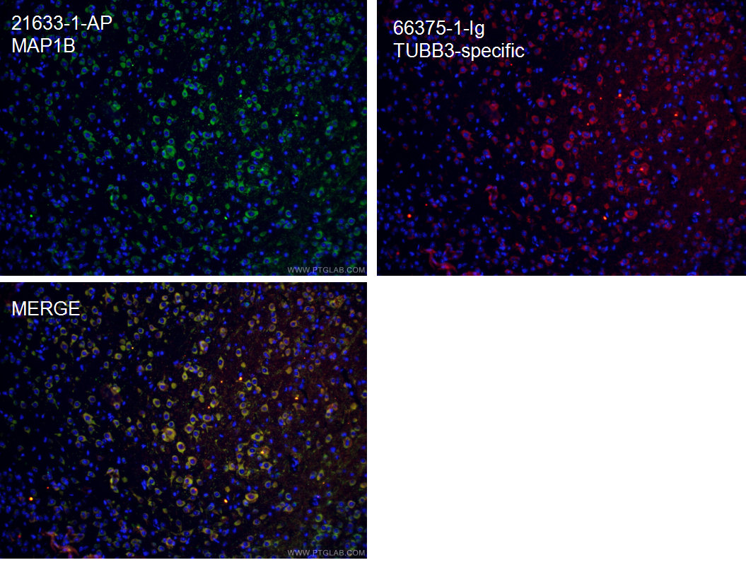 IF Staining of mouse brain using 21633-1-AP