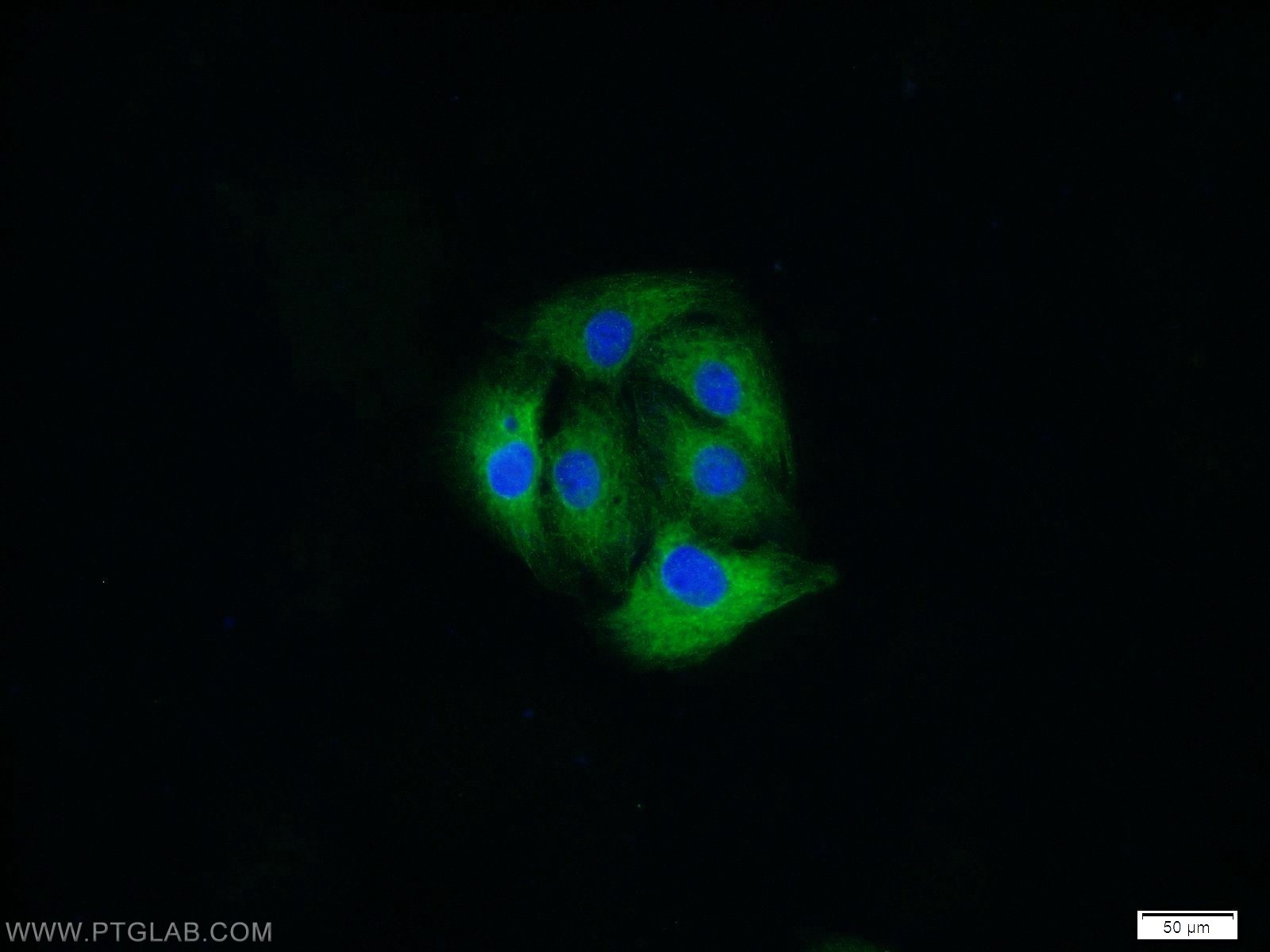 IF Staining of SH-SY5Y using 21633-1-AP